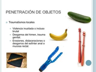 CLASIFICACIÓNCircunstancias de hechoAcceso carnal, penetración con objetos, penetración bucal o anal.Circunstancias etiológicasViolencia