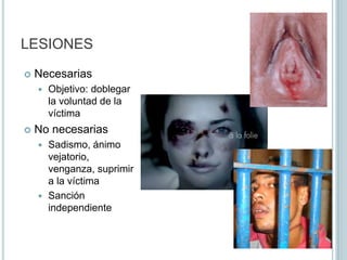 Violencia físicaUso de la fuerza física que actúa sobre la víctima para conseguir el fin propuestoVencer la resistencia de la víctimaFrecuente e importante en adultos