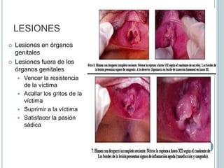 Resistencia que opone el sujeto pasivo No solo desesperada sino real y decisivaExteriorice voluntad contraria a la realización del acto sexualLesiones grandes, pequeñas o ausentes