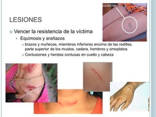 LESIONESNecesarias Objetivo: doblegar la voluntad de la víctimaNo necesariasSadismo, ánimo vejatorio, venganza, suprimir a la víctimaSanción independiente