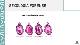 SEXOLOGIA FORENSE
CLASSIFICAÇÕES DE HÍMENS
 