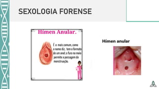 SEXOLOGIA FORENSE
 
