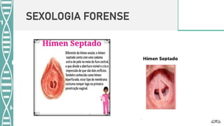 SEXOLOGIA FORENSE
 
