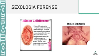 SEXOLOGIA FORENSE
 