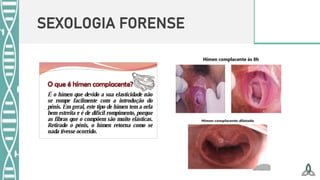 SEXOLOGIA FORENSE
 