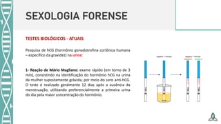 SEXOLOGIA FORENSE
TESTES BIOLÓGICOS - ATUAIS
Pesquisa de hCG (hormônio gonadotrofina coriônica humana
– específico da gravidez) na urina:
1- Reação de Mário Magliano: exame rápido (em torno de 3
min), consistindo na identificação do hormônio hCG na urina
da mulher supostamente grávida, por meio do soro anti-hCG.
O teste é realizado geralmente 12 dias após a ausência da
menstruação, utilizando preferencialmente a primeira urina
do dia pela maior concentração do hormônio.
 