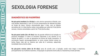 SEXOLOGIA FORENSE
DIAGNÓSTICO DO PUERPÉRIO
No pós-parto imediato (1 a 10 dias): o colo uterino apresenta-se flácido, com
suas bordas distensíveis e com 12 cm de comprimento do rebordo do púbis
ao fundo do útero. Cérvice reconstituída após 3 dias, com os lóquios
vermelhos de 2 a 3 dias (lochia rubra), mais pálidos por volta do 5º dia (lochia
serosa), e branco-amarelados a partir do 7º dia (lochia alba).
No pós-parto tardio (10 a 45 dias): fase de grande influência da lactação no
processo fisiológico. O útero se encontra reduzindo o seu volume, já no
interior da pélvis, e o colo se apresenta em forma de fundo transverso. O
corrimento loquial serossanguinolento se torna seroso (lochia serosa ou
lochia flava), indo até no máximo por volta de 4 semanas, adquirindo
tonalidade branca (lochia alba).
No pós-parto remoto (além de 45 dias): varia de acordo com a lactação, sendo mais longo e impreciso,
principalmente nas mulheres lactantes. A loquiação se apresenta lochia alba ou inexistente já neste período.
 