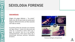 SEXOLOGIA FORENSE
DOCIMÁSIAS
Origem do grego dokimos = “eu provo”.
Nada mais são do que testes de provas para
diagnose diferencial entre um feto nascente
com vida ou morto.
Os pulmões do feto são colocados num recipiente
com água, (flutuar = nasceu com vida já que está
cheio de ar tornando-se menos denso que a
água). No contrário, não há ar nos pulmões,
consequentemente, o feto nasceu morto. Daí, a
denominação docimasia pulmonar hidrostática
de Galeno.
Pulmonar, Diafragma, Extrapulmonar.
 