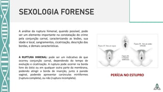 SEXOLOGIA FORENSE
A análise da ruptura himenal, quando possível, pode
ser um elemento importante na constatação do crime
pela conjunção carnal, caracterizando as lesões, sua
idade e local, sangramentos, cicatrização, descrição das
bordas, e demais características.
A RUPTURA HIMENAL: pode ser um indicativo de que
ocorreu conjunção carnal, dependendo do tempo de
evolução e cicatrização. A ruptura pode ocorrer na borda
livre do óstio ou em qualquer outra parte da membrana,
podendo atingir a borda de inserção, junto à parede
vaginal, podendo apresentar carúnculas mirtiformes
(ruptura completa), ou não (ruptura incompleta).
PERÍCIA NO ESTUPRO
 