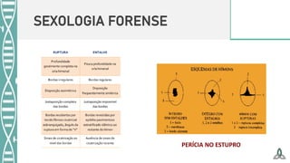 SEXOLOGIA FORENSE
PERÍCIA NO ESTUPRO
 