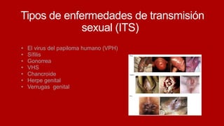 Tipos de enfermedades de transmisión
sexual (ITS)
• El virus del papiloma humano (VPH)
• Sífilis
• Gonorrea
• VHS
• Chancroide
• Herpe genital
• Verrugas genital
 