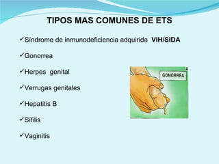 TIPOS MAS COMUNES DE ETS Síndrome de inmunodeficiencia adquirida  VIH/SIDA Gonorrea Herpes  genital  Verrugas genitales Hepatitis B Sífilis Vaginitis  