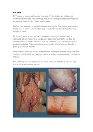 VIH/SIDA
El Virus de la Immunodeficiencia Humana (VIH) infecta a las células del
sistema inmunológico y las destruye, reduciendo la capacidad del cuerpo para
protegerse de otras infecciones y del cáncer.
No hay cura: la persona queda infectada de por vida. Si empieza a desarrollar
infecciones o cáncer se considera que tiene Síndrome de Inmunodeficiencia
Adquirido, sida.
El VIH se transmite sólo a través del ingreso de sangre, semen, fluidos
vaginales o leche materna al cuerpo. Las dos maneras más frecuentes de
contagiarse es por sexo vaginal o anal sin condón o por compartir jeringas o
agujas infectadas. El virus puede pasar de madre a bebé antes o durante el
parto y al darle de mamar.
Otras vías de contagio son las transfusiones de sangre, el sexo oral y en menor
medida en el dentista o a través de besos, si ambas personas tienen heridas en
la boca.
Los síntomas no son inmediatos. La única forma de detectar el virus es por
medio de un examen de sangre
 