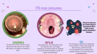 ITS mas comunes
SIFILIS
Causada por una bacteria que
comienza con una llaga
indolora. Se desarrolla en etapas
y los síntomas pueden variar en
cada una de ellas.
VIH
Virus ataca y debilita al sistema
inmunitario. Fase avanzada se
denomina, síndrome de
inmunodeficiencia adquirida ,
puede tardar muchos años en
GONORREA
El síntoma más común es la
secreción de pus en el cuello
del útero, la vagina, el pene o
ano.
 