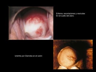 En la sexualidad no se debe perder la expontaneidad 