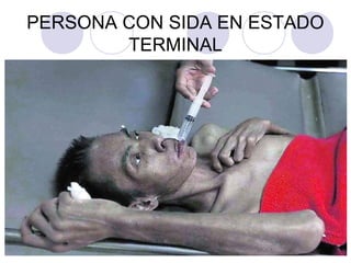 PERSONA CON SIDA EN ESTADO
TERMINAL
 