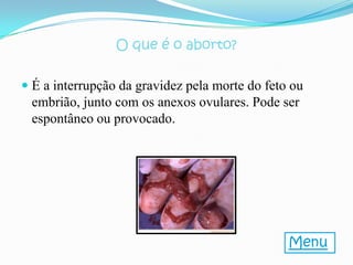 O que é o aborto?

 É a interrupção da gravidez pela morte do feto ou
  embrião, junto com os anexos ovulares. Pode ser
  espontâneo ou provocado.




                                                Menu
 
