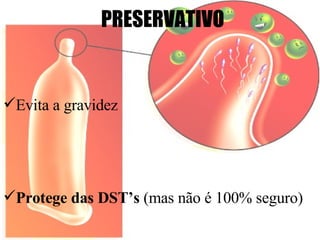 PRESERVATIVO   Evita a gravidez Protege das DST’s  (mas não é 100% seguro) 