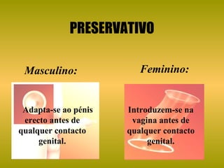PRESERVATIVO Masculino:  Adapta-se ao pénis erecto antes de qualquer contacto genital. Introduzem-se na vagina antes de qualquer contacto genital. Feminino:   