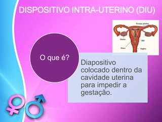 DISPOSITIVO INTRA-UTERINO (DIU)
Diapositivo
colocado dentro da
cavidade uterina
para impedir a
gestação.
O que é?
 