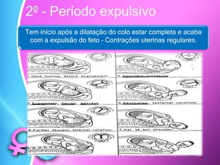 2º - Período expulsivo
Tem início após a dilatação do colo estar completa e acaba
com a expulsão do feto – Contrações uterinas regulares.
 