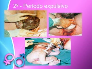 2º - Período expulsivo
 