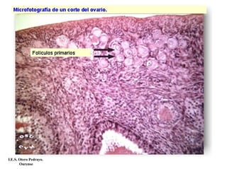 I.E.S. Otero Pedrayo.
Ourense
 