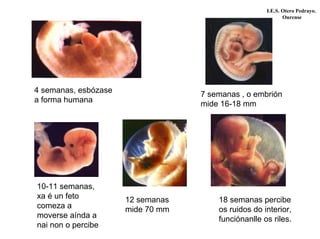 I.E.S. Otero Pedrayo.
Ourense
4 semanas, esbózase
a forma humana
7 semanas , o embrión
mide 16-18 mm
10-11 semanas,
xa é un feto
comeza a
moverse aínda a
nai non o percibe
12 semanas
mide 70 mm
18 semanas percibe
os ruidos do interior,
funciónanlle os riles.
 