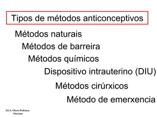 Tipos de métodos anticonceptivos
Métodos naturais
Métodos de barreira
Métodos químicos
Dispositivo intrauterino (DIU)
Métodos cirúrxicos
Método de emerxencia
I.E.S. Otero Pedrayo.
Ourense
 