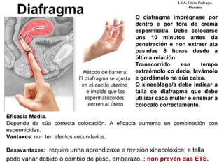 Diafragma O diafragma imprégnase por
dentro e por fóra de crema
espermicida. Debe colocarse
uns 10 minutos antes da
penetración e non extraer ata
pasadas 8 horas desde a
última relación.
Transcorrido ese tempo
extraémolo co dedo, lavámolo
e gardámolo na súa caixa.
O xinecólogo/a debe indicar a
talla de diafragma que debe
utilizar cada muller e ensinar a
colocalo correctamente.
Eficacia Media.
Depende da súa correcta colocación. A eficacia aumenta en combinación con
I.E.S. Otero Pedrayo.
Ourense
espermicidas.
Vantaxes: non ten efectos secundarios.
Desavantaxes: require unha aprendizaxe e revisión xinecolóxica; a talla
pode variar debido ó cambio de peso, embarazo..; non prevén das ETS.
 