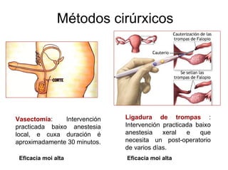 Métodos cirúrxicos
Ligadura de trompas :
Intervención practicada baixo
anestesia xeral e que
necesita un post-operatorio
de varios días.
Vasectomía: Intervención
practicada baixo anestesia
local, e cuxa duración é
aproximadamente 30 minutos.
Eficacia moi alta Eficacia moi alta
 