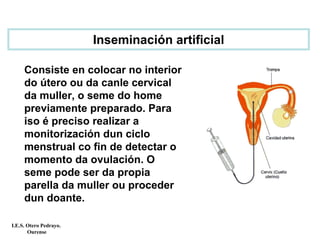 Inseminación artificial
Consiste en colocar no interior
do útero ou da canle cervical
da muller, o seme do home
previamente preparado. Para
iso é preciso realizar a
monitorización dun ciclo
menstrual co fin de detectar o
momento da ovulación. O
seme pode ser da propia
parella da muller ou proceder
dun doante.
I.E.S. Otero Pedrayo.
Ourense
 