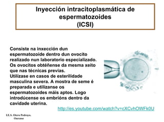 Inyección intracitoplasmática de
espermatozoides
(ICSI)
Consiste na inxección dun
espermatozoide dentro dun ovocito
realizado nun laboratorio especializado.
Os ovocitos obtéñense da mesma xeito
que nas técnicas previas.
Utilízase en casos de esterilidade
masculina severa. A mostra de seme é
preparada e utilízanse os
espermatozoides máis aptos. Logo
introdúcense os embrións dentro da
cavidade uterina.
http://es.youtube.com/watch?v=cXCvhOWFk0U
I.E.S. Otero Pedrayo.
Ourense
 