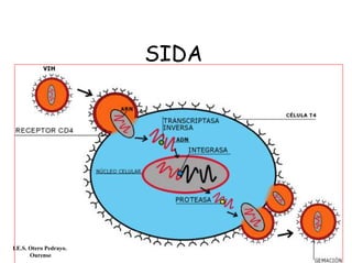 SIDA
I.E.S. Otero Pedrayo.
Ourense
 
