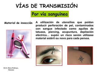 VÍAS DE TRANSMISIÓN
Por vía sanguínea
A utilización de utensilios que poidan
producir perforación de pel, contaminados
con sangue infectado como agullas de
tatuaxe, piercing, acupuntura, depilación
eléctrica… supón un risco senón utilízase
material estéril ou novo para cada persoa.
Material de inxección
I.E.S. Otero Pedrayo.
Ourense
 