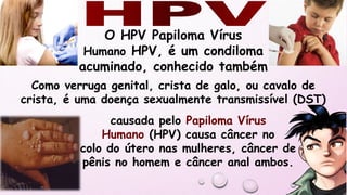 O HPV Papiloma Vírus
Humano HPV, é um condiloma
acuminado, conhecido também
causada pelo Papiloma Vírus
Humano (HPV) causa câncer no
colo do útero nas mulheres, câncer de
pênis no homem e câncer anal ambos.
Como verruga genital, crista de galo, ou cavalo de
crista, é uma doença sexualmente transmissível (DST)
 