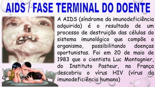 A AIDS (síndrome da imunodeficiência
adquirida) é o resultado de um
processo de destruição das células do
sistema imunológico que compõe o
organismo, possibilitando doenças
oportunistas. Foi em 20 de maio de
1983 que o cientista Luc Montagnier,
do Instituto Pasteur, na França
descobriu o vírus HIV (vírus da
imunodeficiência humana)
 