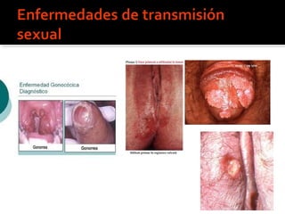 Sexualidad humana