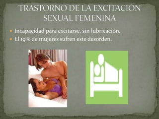 Incapacidad para excitarse, sin lubricación.El 19% de mujeres sufren este desorden.TRASTORNO DE LA EXCITACIÓN SEXUAL FEMENINA