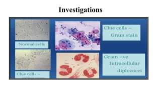 Vaginitis (TV + BV + Candida)
• T. Secnidazole 2g single dose (or)
• T. Tinidazole 500mg BD 5D
• T. Metoclopropramide 30 mts before T. secnidazole to prevent GI
Candidiasis
• T. Fluconazole 150mg single dose (or) Clotrimazole 500mg pessaries once
Cervicitis (chlamydia + gonorrhoea)
• T. Cefixime 400mg single dose + T. Azithromycin 1g 1 hour before lunch
• If vomiting within 1 hour – give anti emetic & repeat
• Avoid douching
• Récurrent infection – consider pregnancy, diabetes & HIV
• Follow up after a week
 