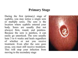 Primary Stage
During the first (primary) stage of
syphilis, you may notice a single sore
or multiple sores. The sore is the
location where syphilis entered your
body. Sores are usually (but not
always) firm, round, and painless.
Because the sore is painless, it can
easily go unnoticed. The sore usually
lasts 3 to 6 weeks and heals regardless
of whether or not you receive
treatment. Even after the sore goes
away, you must still receive treatment.
This will stop your infection from
moving to the secondary stage
 