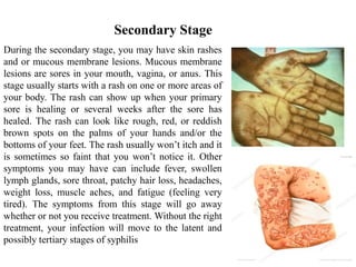 Secondary Stage
During the secondary stage, you may have skin rashes
and or mucous membrane lesions. Mucous membrane
lesions are sores in your mouth, vagina, or anus. This
stage usually starts with a rash on one or more areas of
your body. The rash can show up when your primary
sore is healing or several weeks after the sore has
healed. The rash can look like rough, red, or reddish
brown spots on the palms of your hands and/or the
bottoms of your feet. The rash usually won’t itch and it
is sometimes so faint that you won’t notice it. Other
symptoms you may have can include fever, swollen
lymph glands, sore throat, patchy hair loss, headaches,
weight loss, muscle aches, and fatigue (feeling very
tired). The symptoms from this stage will go away
whether or not you receive treatment. Without the right
treatment, your infection will move to the latent and
possibly tertiary stages of syphilis
 
