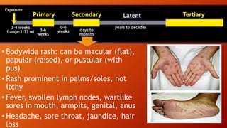 • Bodywide rash: can be macular (flat),
papular (raised), or pustular (with
pus)
• Rash prominent in palms/soles, not
itchy
• Fever, swollen lymph nodes, wartlike
sores in mouth, armpits, genital, anus
• Headache, sore throat, jaundice, hair
loss
 