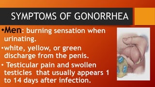 SYMPTOMS OF GONORRHEA
•Men: burning sensation when
urinating.
•white, yellow, or green
discharge from the penis.
• Testicular pain and swollen
testicles that usually appears 1
to 14 days after infection.
 