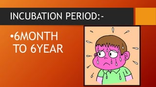 INCUBATION PERIOD:-
•6MONTH
TO 6YEAR
 