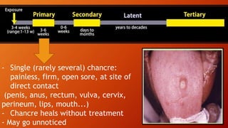 - Single (rarely several) chancre:
painless, firm, open sore, at site of
direct contact
(penis, anus, rectum, vulva, cervix,
perineum, lips, mouth...)
- Chancre heals without treatment
- May go unnoticed
 