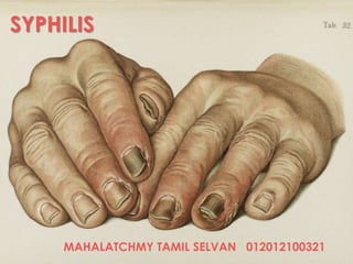 MAHALATCHMY TAMIL SELVAN 012012100321
SYPHILIS
 