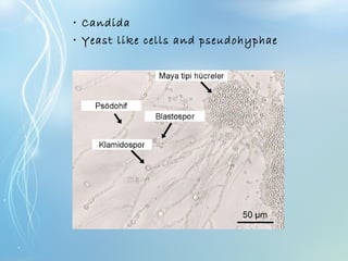 • Candida
• Yeast like cells and pseudohyphae
 