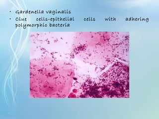 • Gardenella vaginalis
• Clue cells-epithelial cells with adhering
polymorphic bacteria
 