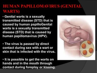 HUMAN PAPILLOMAVIRUS (GENITAL
WARTS)
• Genital warts is a sexually
transmitted disease (STD) that is
caused by human papilloGenital
warts is a sexually transmitted
disease (STD) that is caused by
human papillomavirus (HPV).
• The virus is passed by direct
contact during sex with a wart or
skin that is infected with the virus.
• It is possible to get the warts on
hands and in the mouth through
contact during foreplay or kissing.
 